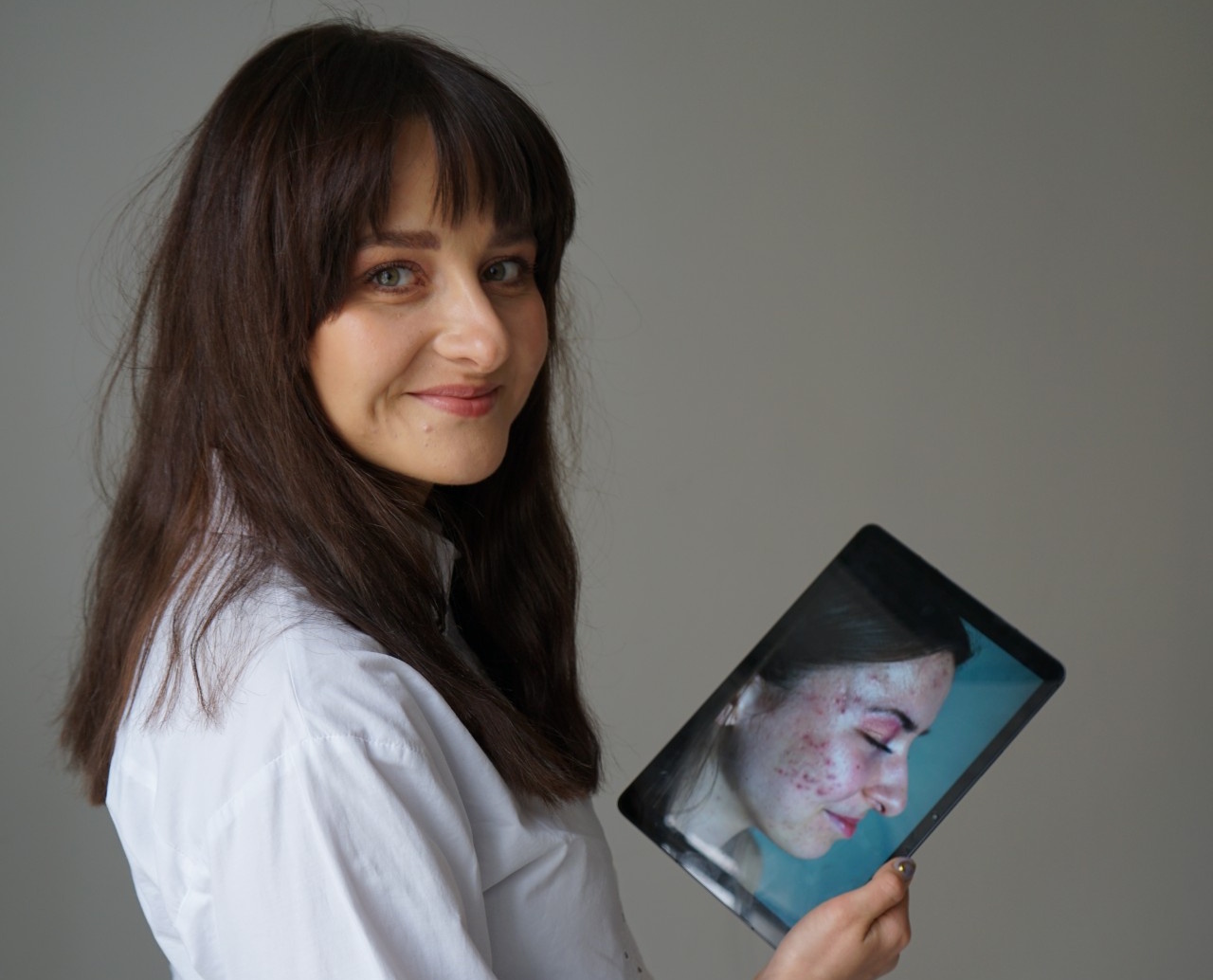 Kozmetikus tanácsai szülőknek: miért romlik ősszel a tinédzserek bőre Budapesten?